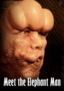 Страдания человека-слона